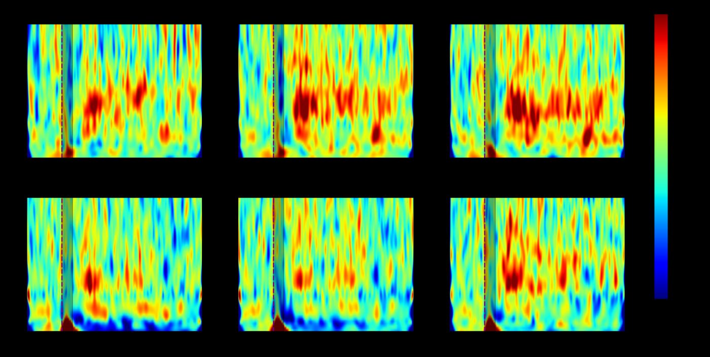 Cartes EEG Prophetic montrant l’activité après stimulation, essais bêta 2026